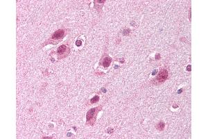 Immunohistochemistry (IHC) image for anti-HECT, UBA and WWE Domain Containing 1, E3 Ubiquitin Protein Ligase (HUWE1) (C-Term) antibody (ABIN213933)