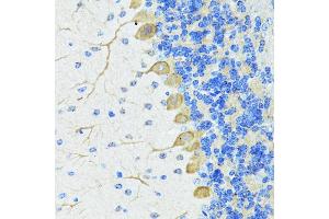 Immunohistochemistry (IHC) image for anti-Nestin (NES) (AA 1392-1621) antibody (ABIN6144536)