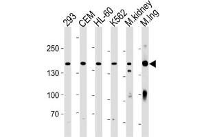 Western Blotting (WB) image for anti-Plakophilin 4 (PKP4) antibody (ABIN3004661) (Plakophilin 4 Antikörper)