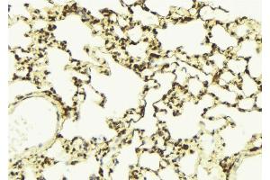 ABIN6268908 at 1/100 staining Mouse lung tissue by IHC-P.
