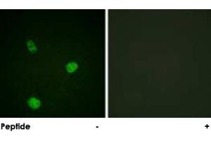 Immunofluorescence analysis of HeLa cells, using MITF polyclonal antibody . (MITF Antikörper  (Ser73, Ser180))