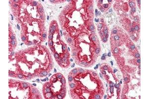 Human Kidney (formalin-fixed, paraffin-embedded) stained with CPT1A antibody at 4 µg/ml followed by biotinylated anti-goat IgG secondary antibody, alkaline phosphatase-streptavidin and chromogen. (CPT1A Antikörper  (Internal Region))