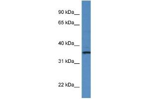 WB Suggested Anti-RIOK1 Antibody Titration: 1.