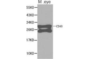 Western Blotting (WB) image for anti-CD40 (CD40) antibody (ABIN1871634) (CD40 Antikörper)