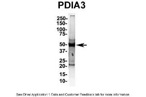 IP Suggested AntiPDIA3 Antibody Positive Control: NT2 CELL/BRAIN TISSUE (PDIA3 Antikörper  (C-Term))