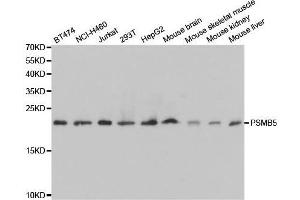 Western blot analysis of extracts of various cell lines, using PSMB5 antibody. (PSMB5 Antikörper  (AA 1-263))