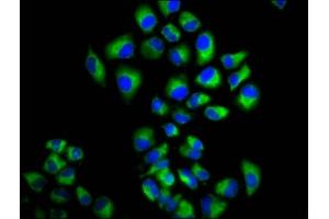 Immunofluorescence staining of Hela cells with ABIN7158207 at 1:166, counter-stained with DAPI. (LRIG2 Antikörper  (AA 833-932))