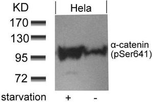 Western blot analysis of extracts from Hela cells untreated or treated with starvation using a-catenin(Phospho-Ser641) antibody. (CTNNA1 Antikörper  (pSer641))
