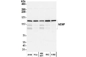 anti-serologically Defined Colon Cancer Antigen 1 (SDCCAG1) (AA 725-775) antibody