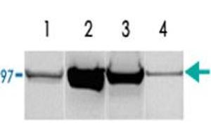 (1) Rat liver homogenate (50 ug of total protein). (PYGM Antikörper)