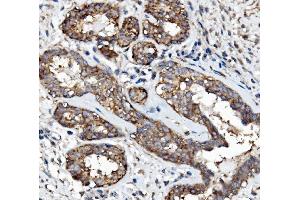 IHC analysis of EGFR using anti-EGFR antibody (ABIN7601478). (EGFR Antikörper  (AA 36-497))