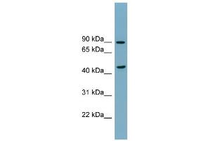 WB Suggested Anti-SMPD2 Antibody Titration:  0. (SMPD2 Antikörper  (N-Term))