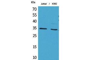 Western Blot (WB) analysis of Jurkat, K562 cells using Acetyl-Ref-1 (K7) Polyclonal Antibody. (APEX1 Antikörper  (acLys7))