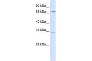 OR6C75 antibody  (C-Term)