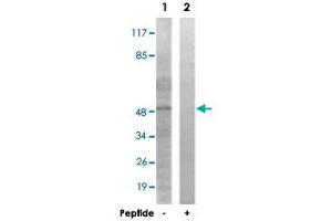Western blot analysis of extracts from 293 cells, using EPB49 polyclonal antibody . (Dematin Antikörper)