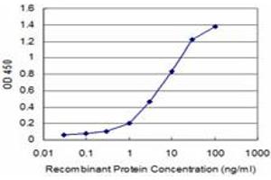 Detection limit for recombinant GST tagged HOXB7 is approximately 0. (HOXB7 Antikörper  (AA 55-120))