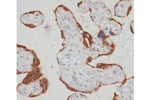 Immunohistochemistry of paraffin-embedded Human placenta using SARS2 Polyclonal Antibody at dilution of 1:100 (40x lens). (SARS2 Antikörper)