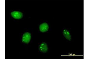 Immunofluorescence of purified MaxPab antibody to C8orf33 on HeLa cell. (C8orf33 Antikörper  (AA 1-229))
