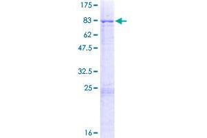 MLKL Protein (AA 1-471) (GST tag)