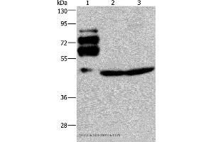 Western blot analysis of Human rectal cancer tissue, Jurkat and HT-29 cell, using PCSK9 Polyclonal Antibody at dilution of 1:200 (PCSK9 Antikörper)