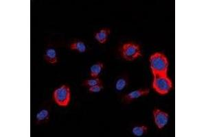 Immunofluorescent analysis of HER2 staining in HepG2 cells. (ErbB2/Her2 Antikörper)