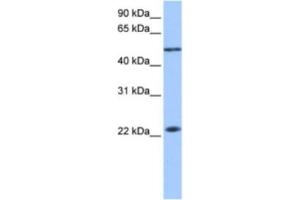 Western Blotting (WB) image for anti-Protein Inhibitor of Activated STAT, 2 (PIAS2) antibody (ABIN2463619) (PIAS2 Antikörper)