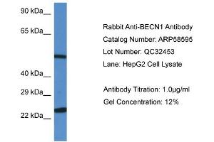 WB Suggested Anti-BECN1 Antibody Titration: 0. (Beclin 1 Antikörper  (N-Term))