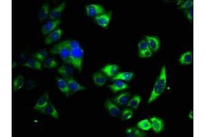 Immunofluorescence staining of Hela cells with ABIN7163520 at 1:33, counter-stained with DAPI. (ATP2B4 Antikörper  (AA 281-345))