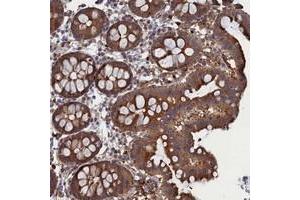 Immunohistochemical staining of human colon with FILIP1L polyclonal antibody  shows strong cytoplasmic positivity in glandular cells. (FIL1L Antikörper)