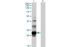 Western Blot analysis of NOL6 expression in transfected 293T cell line by NOL6 MaxPab polyclonal antibody. (Nucleolar Protein 6 Antikörper  (AA 1-200))