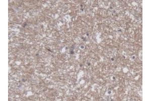 DAB staining on IHC-P; Samples: Human Cerebrum Tissue (CRMP1 Antikörper  (AA 1-250))