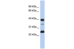 WB Suggested Anti-TMPO Antibody Titration:  0. (Thymopoietin Antikörper  (N-Term))