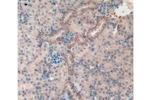 Used in DAB staining on fromalin fixed paraffin- embedded kidney tissue (PITRM1 Antikörper  (AA 653-926))