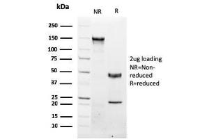 SDS-PAGE Analysis Purified NKX3. (NKX3-1 Antikörper  (AA 92-224))