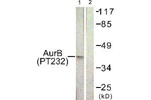 Immunohistochemistry analysis of paraffin-embedded human liver carcinoma tissue using AurB (Phospho-Thr232) antibody.