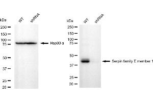 anti-Plasminogen Activator Inhibitor 1 (SERPINE1) antibody