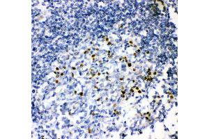 Anti- MUM1 antibody, IHC(P) IHC(P): Human Tonsil Tissue (IRF4 Antikörper  (AA 272-451))