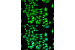 Immunofluorescence analysis of A549 cells using TREX1 antibody. (TREX1 Antikörper  (AA 1-270))