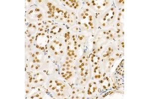 Immunohistochemistry (IHC) image for anti-Histone H4 (acLys8) antibody (ABIN7267747)