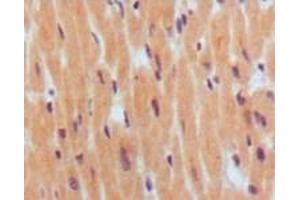 Immunohistochemistry (IHC) image for anti-Brain Natriuretic Peptide (BNP) antibody (ABIN2464019) (BNP Antikörper)