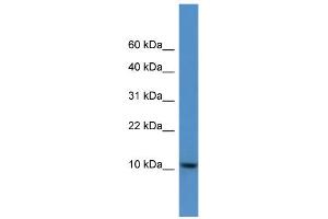 WB Suggested Anti-DNAJC19 Antibody Titration: 0. (DNAJC19 Antikörper  (C-Term))