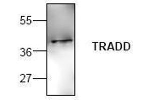 Image no. 1 for anti-TNFRSF1A-Associated Via Death Domain (TRADD) antibody (ABIN127191) (TRADD Antikörper)