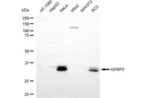 Western blotting analysis using IGFBP2 antibody (ABIN7799054). (Rekombinanter IGFBP2 Antikörper)