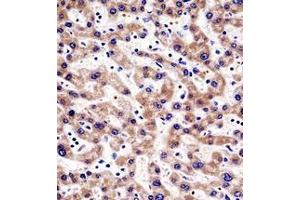 Immunohistochemistry analysis in formalin fixed and paraffin embedded human liver tissue reacted with HTATIP2 Antibody (N-term) followed which was peroxidase conjugated to the secondary antibody and followed by AB staining. (HIV-1 Tat Interactive Protein 2, 30kDa (HTATIP2) (AA 44-74), (N-Term) Antikörper)