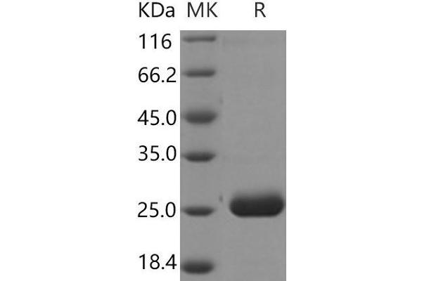 Prolactin Family 2, Subfamily A, Member 1 (PRL2A1) protein (His tag)