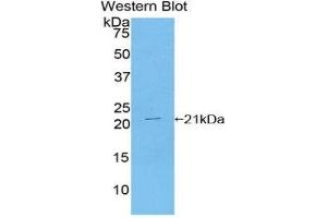 Western Blotting (WB) image for anti-TAR DNA Binding Protein (TARDBP) (AA 104-262) antibody (ABIN1860694) (TARDBP Antikörper  (AA 104-262))
