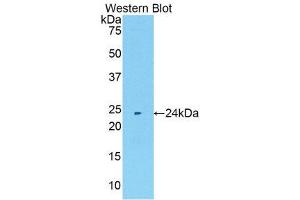 Western Blotting (WB) image for anti-Matrix Metallopeptidase 11 (Stromelysin 3) (MMP11) (AA 302-458) antibody (ABIN1172602)