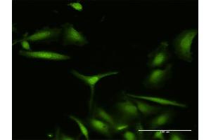 Immunofluorescence of purified MaxPab antibody to S100A7 on HeLa cell. (S100A7 Antikörper  (AA 1-101))