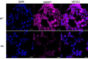 Immunocytochemical staining of HeLa cells using WDR77 antibody (ABIN7800857), 1:1,000), Top panel: wild-type (WT), Bottom panal: WDR77 shRNA knockdown (KD). (WDR77 Antikörper)