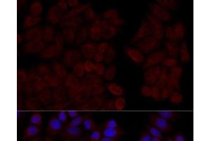 Immunofluorescence analysis of HeLa cells using CALM1 Polyclonal Antibody at dilution of 1:100 (40x lens). (Calmodulin 1 Antikörper)
